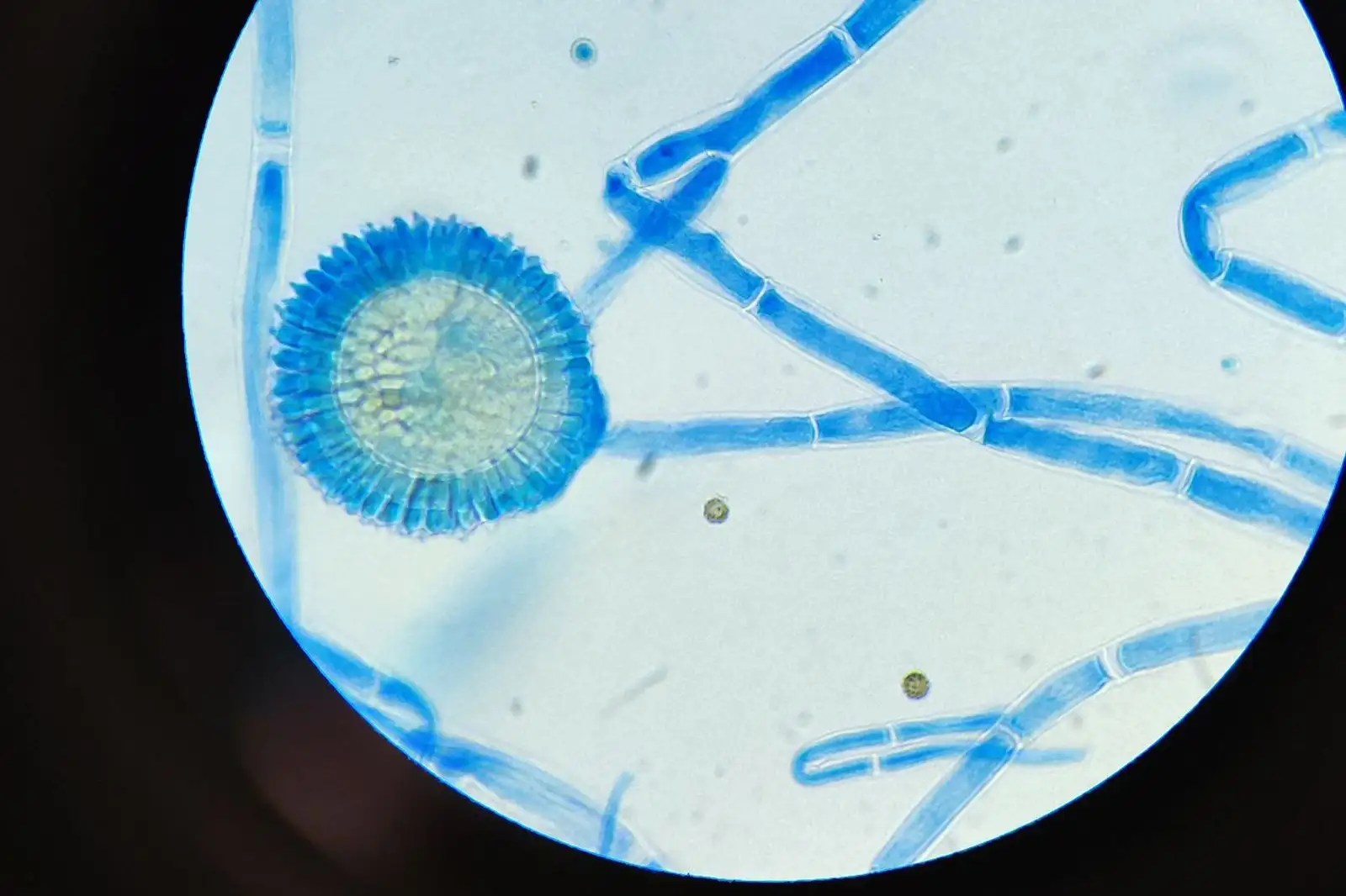 Filaments et tête sporifère d'une moisissure vus au microscope, colorés au bleu