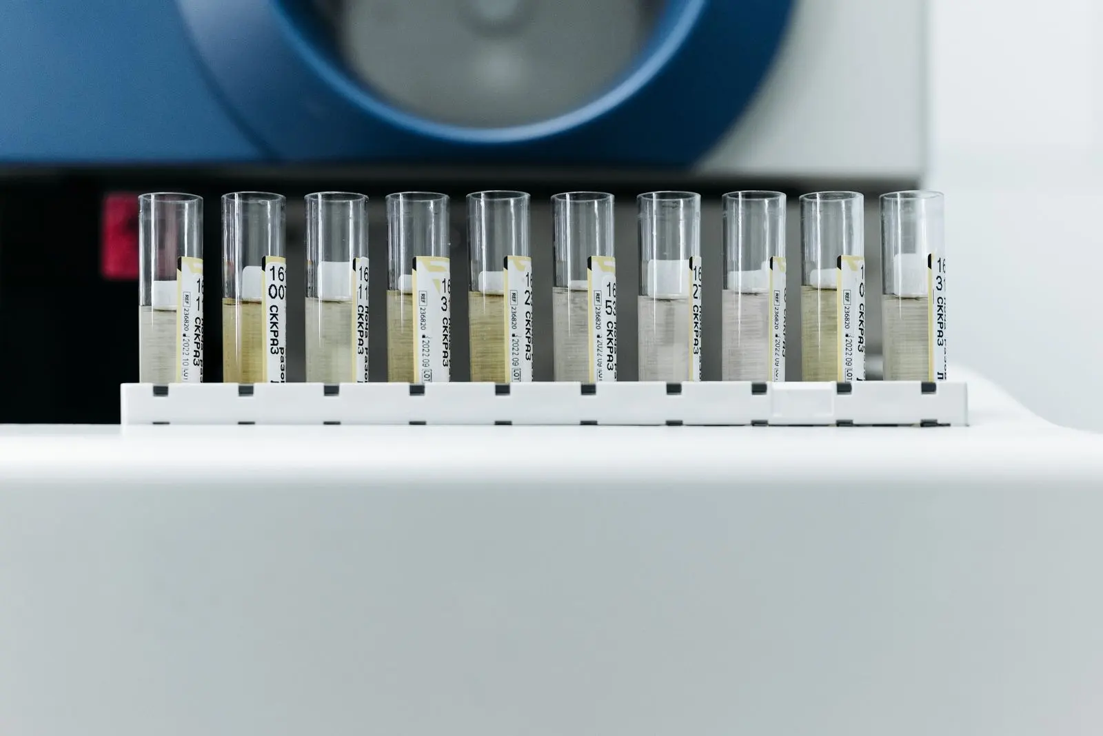 Rangée de tubes d'échantillons d'urine étiquetés, posés devant un automate d'analyse de laboratoire