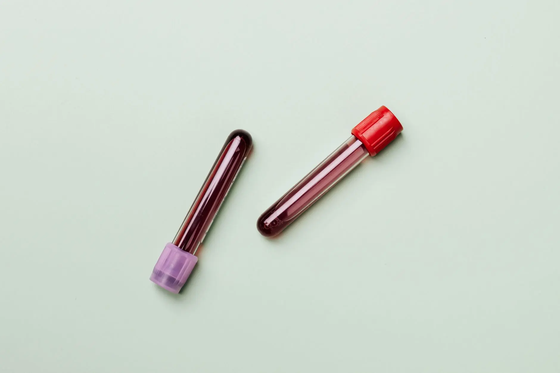 Tubes de prélèvement sanguin en laboratoire d'analyse